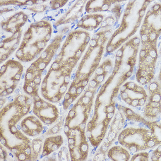 Erlin-2 Rabbit mAb