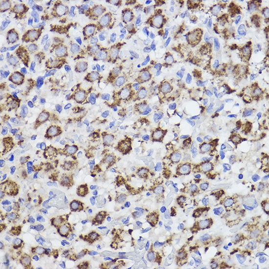 Erlin-2 Rabbit mAb