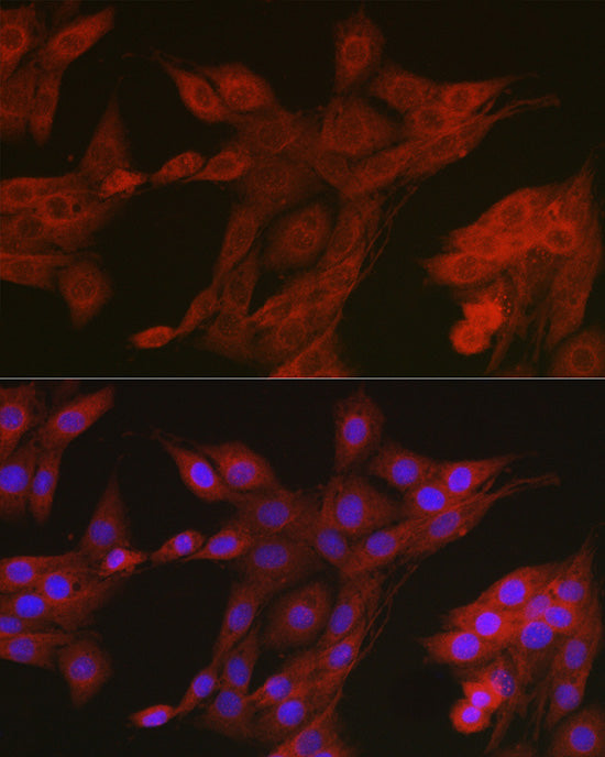 AMPKα2 Rabbit pAb