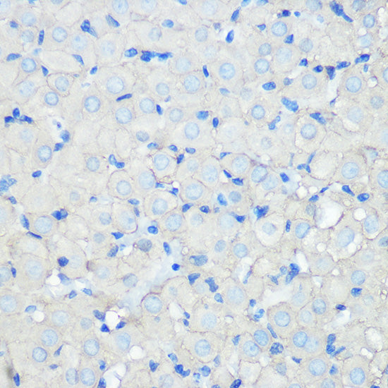 SR-BI Rabbit mAb