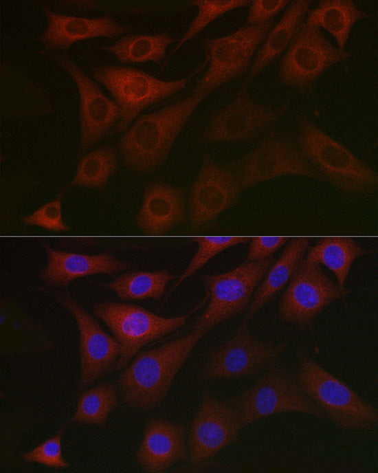PDK1/PDHK1 Rabbit pAb