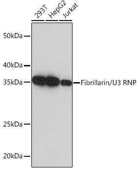 Fibrillarin/U3 RNP Rabbit mAb