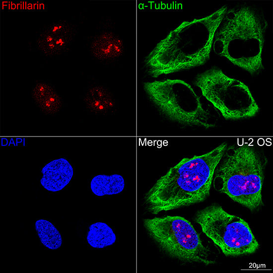 Fibrillarin/U3 RNP Rabbit mAb