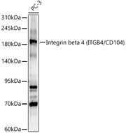 Integrin beta 4 (ITGB4/CD104) Rabbit pAb