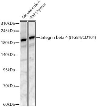 Integrin beta 4 (ITGB4/CD104) Rabbit pAb