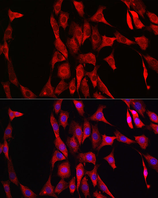 [KO Validated] LDHA Rabbit mAb