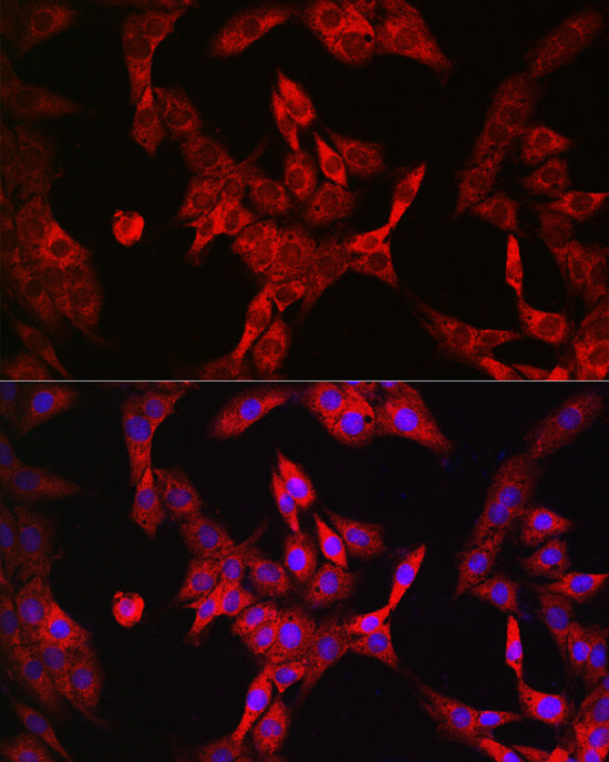 [KO Validated] LDHA Rabbit mAb