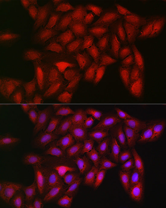 [KO Validated] LDHA Rabbit mAb