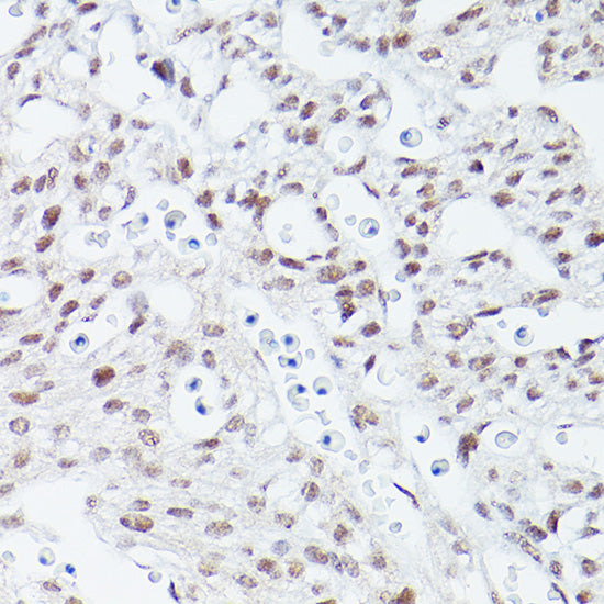 Islet1 Rabbit mAb