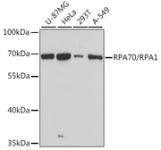 RPA70/RPA1 Rabbit pAb