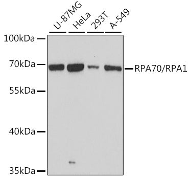 RPA70/RPA1 Rabbit pAb