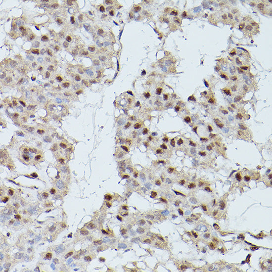 CDK9 Rabbit pAb