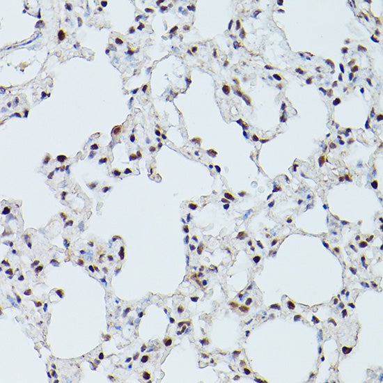 CDK9 Rabbit pAb