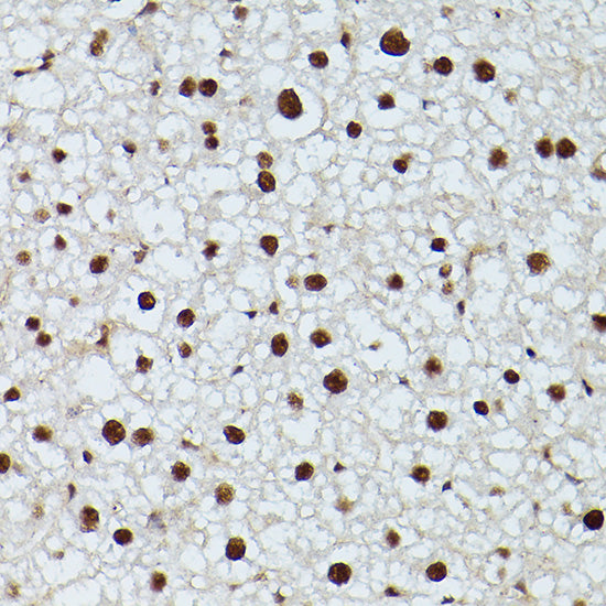 CDK9 Rabbit pAb