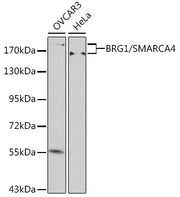[KO Validated] BRG1/SMARCA4 Rabbit pAb