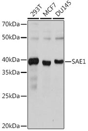SAE1 Rabbit mAb