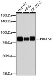 PRKCSH Rabbit mAb
