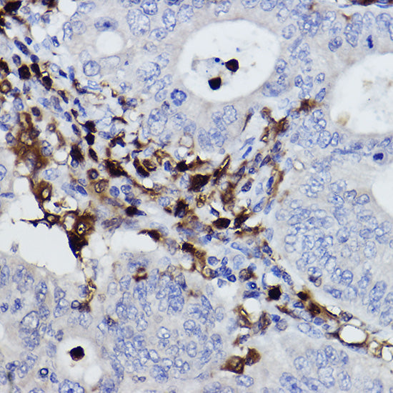 NCF4/p40-phox Rabbit mAb