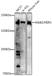 [KO Validated] ErbB3/HER3 Rabbit pAb