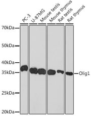 Olig1 Rabbit mAb