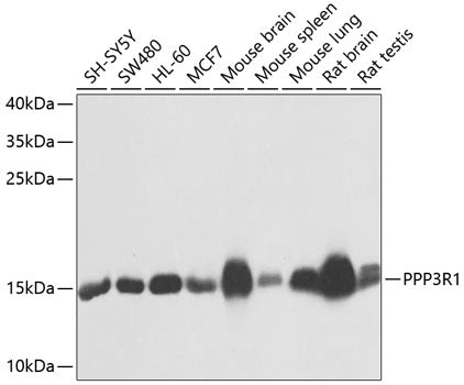 PPP3R1 Rabbit pAb