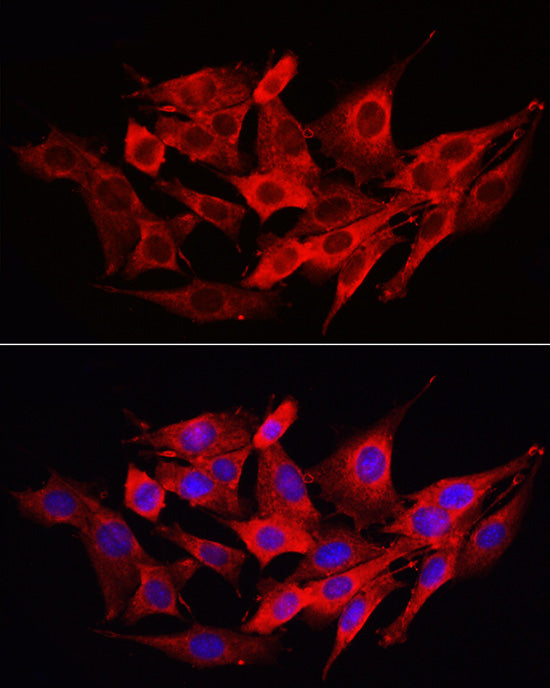 Caspase-1 Rabbit pAb