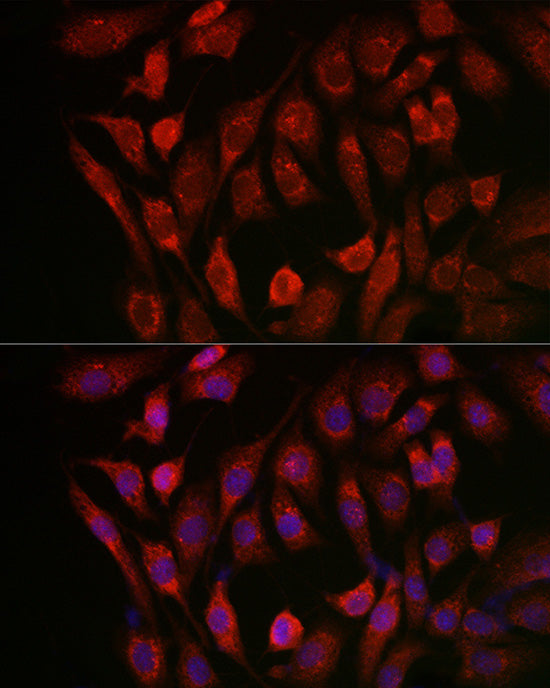 Cathepsin B Rabbit pAb