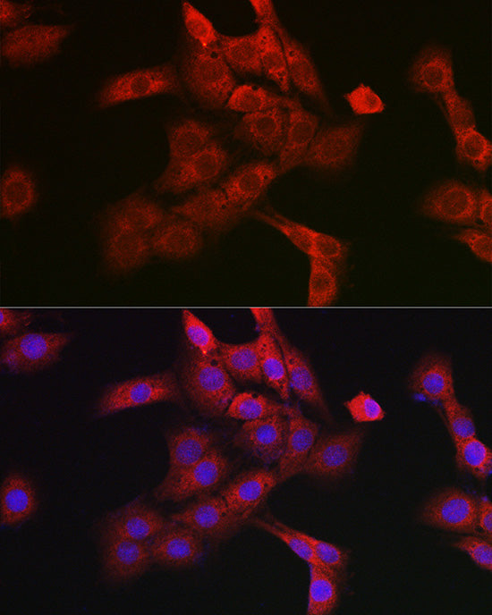 Cathepsin B Rabbit pAb