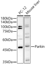 Human Parkin Rabbit pAb