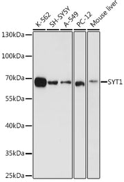 SYT1 Rabbit pAb