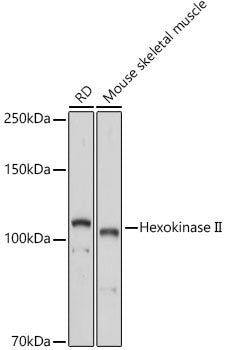 Hexokinase II Rabbit pAb