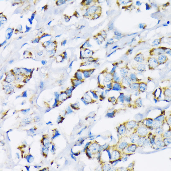 Hexokinase II Rabbit pAb
