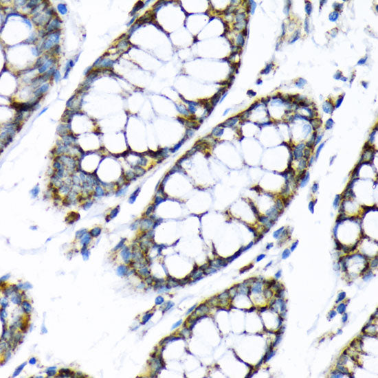 Hexokinase II Rabbit pAb