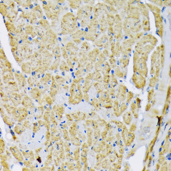 Hexokinase II Rabbit pAb