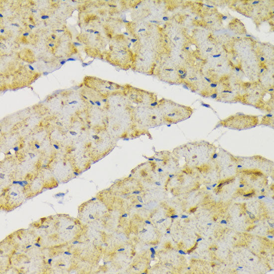 Hexokinase II Rabbit pAb