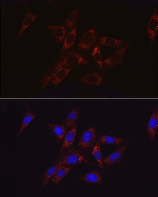Hexokinase II Rabbit pAb