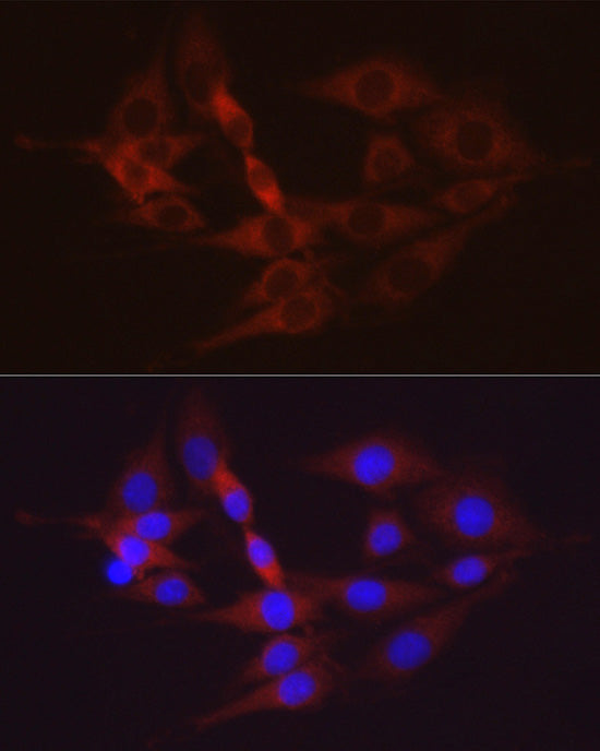 Hexokinase II Rabbit pAb