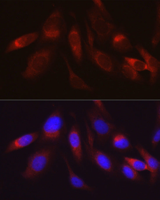 Hexokinase II Rabbit pAb