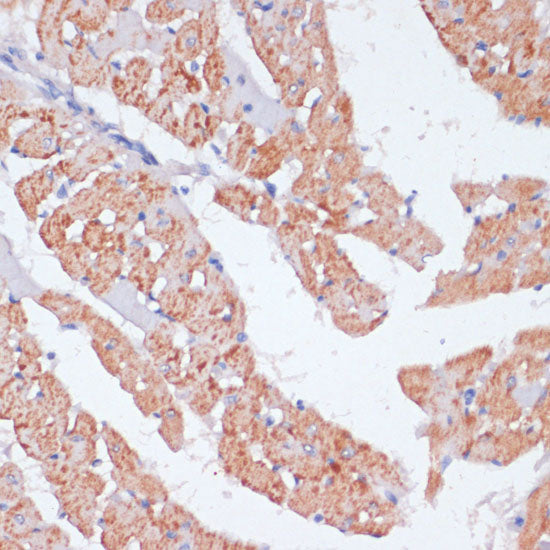 β-arrestin1 Rabbit pAb