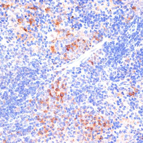 β-arrestin1 Rabbit pAb