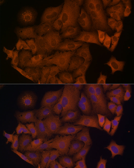 β-arrestin1 Rabbit pAb