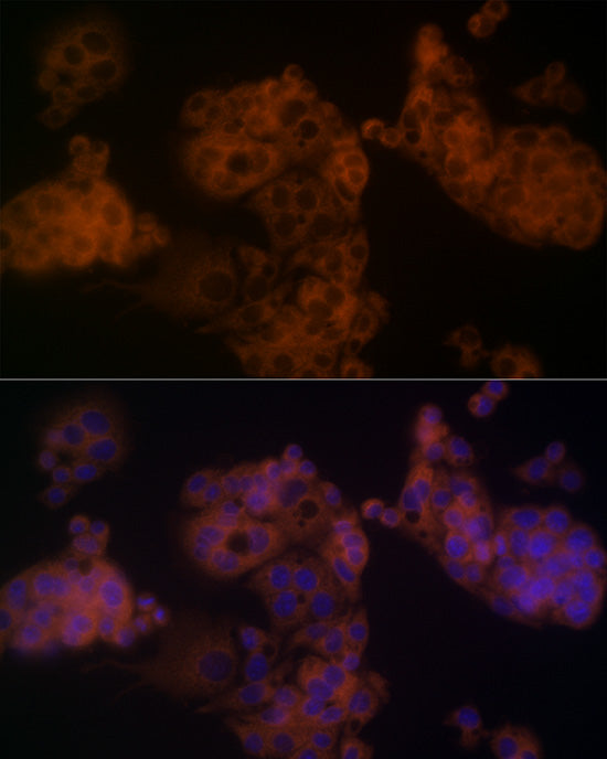 β-arrestin1 Rabbit pAb