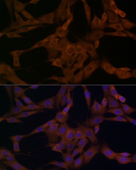 β-arrestin1 Rabbit pAb