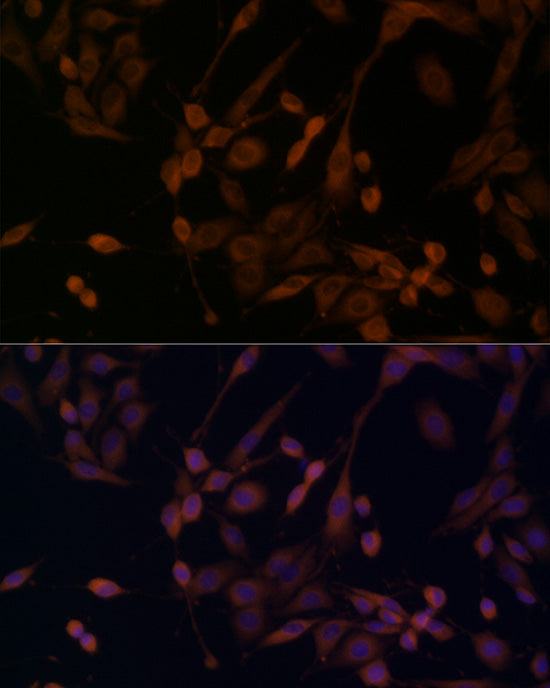 β-arrestin1 Rabbit pAb