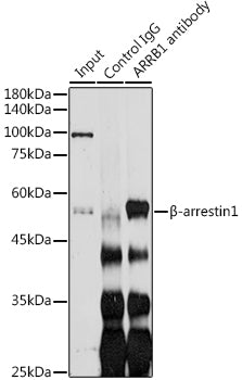 β-arrestin1 Rabbit pAb