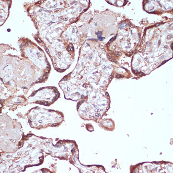 YAP1 Rabbit pAb