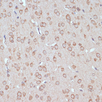 YAP1 Rabbit pAb