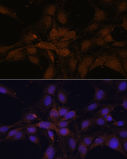 YAP1 Rabbit pAb