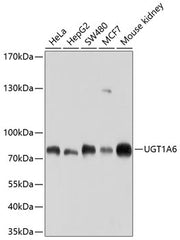UGT1A6 Rabbit pAb