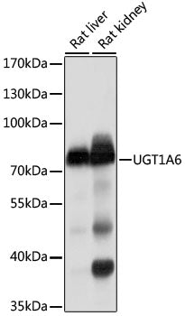 UGT1A6 Rabbit pAb